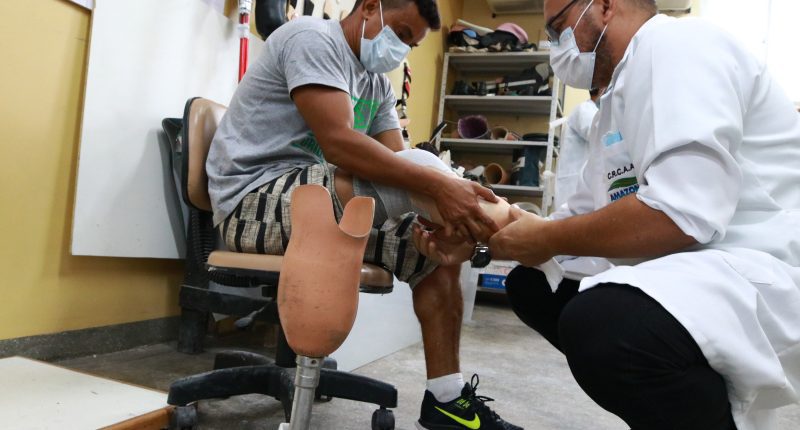 Oficina ortopédica dobra atendimentos com próteses gratuitas em Manaus