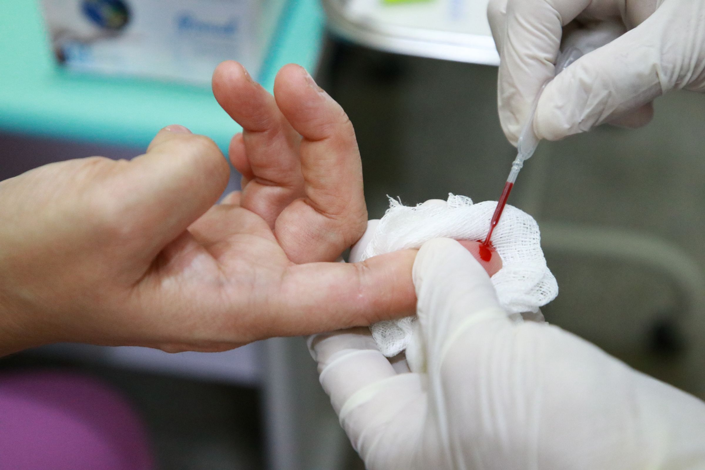 Maio Vermelho alerta para prevenção, diagnóstico e tratamento das hepatites virais