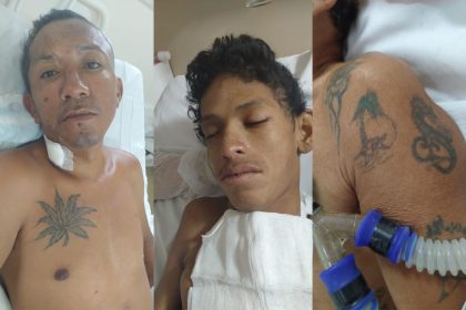 Hospital João Lúcio procura família de homens atropelados