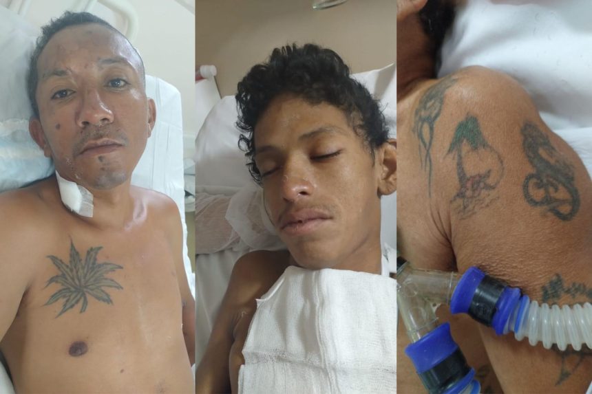 Hospital João Lúcio procura família de homens atropelados