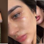 Vídeo: Miss Amazonas denuncia ex-namorado após surgir cheia de hematomas pelo corpo