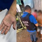 Mãos de uma mulher com marcas de queimaduras, lado a lado com um policial civil prendendo um suspeito de tortura.