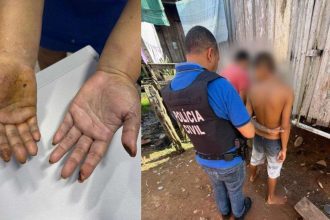 Mãos de uma mulher com marcas de queimaduras, lado a lado com um policial civil prendendo um suspeito de tortura.
