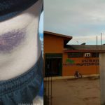 Uma pessoa com uma grande marca roxa no corpo, que parece ser um hematoma, e uma escola com a fachada amarela.