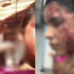 Imagem colorida mostra agressões sofridas por Alana