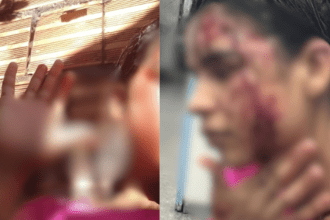 Imagem colorida mostra agressões sofridas por Alana