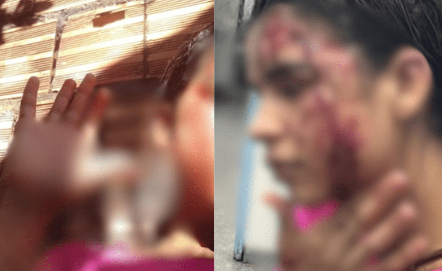 Imagem colorida mostra agressões sofridas por Alana