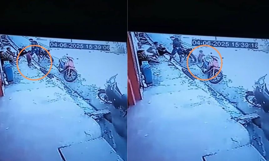 Criança atropelada por moto em Tefé, Amazonas