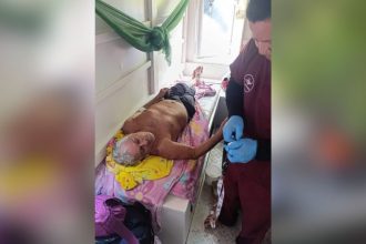 Idoso recebendo cuidados médicos após ser encontrado em Atalaia do Norte.