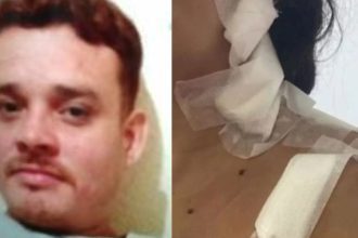 Foto de Ramon Costa de Souza, homem morto com curativos no ombro.