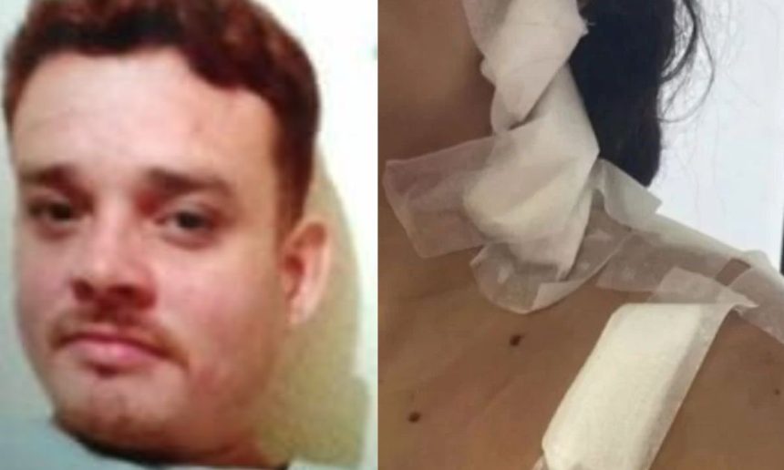 Foto de Ramon Costa de Souza, homem morto com curativos no ombro.