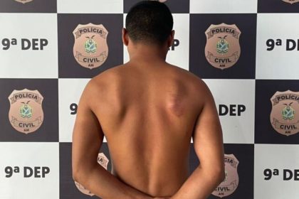 Homem com hematomas nas costas em frente a um fundo da polícia. Militar é preso por tentativa de feminicídio.