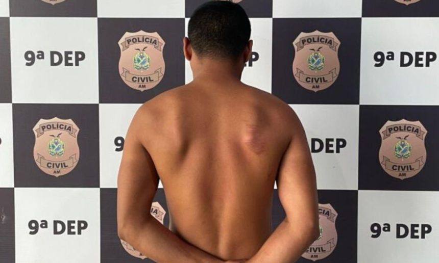 Homem com hematomas nas costas em frente a um fundo da polícia. Militar é preso por tentativa de feminicídio.