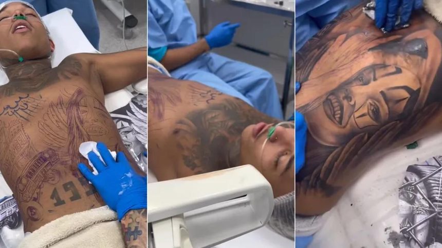 Dj Gustavo o Brabo em 2023 recebendo tatuagem no peito após anestesia geral, com desenho de palhaço e outros elementos.