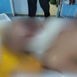 Idoso tem pescoço golpeado por terçado ao reagir a assalto no Amazonas