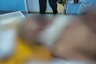 Idoso tem pescoço golpeado por terçado ao reagir a assalto no Amazonas