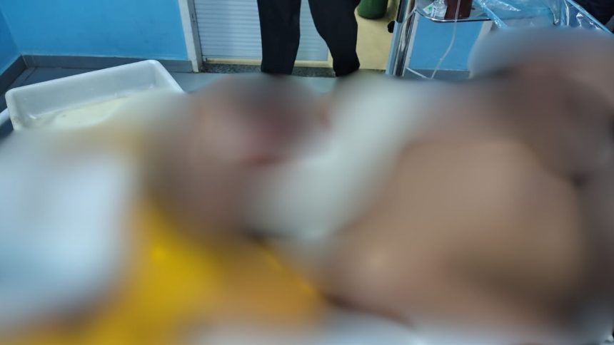 Idoso tem pescoço golpeado por terçado ao reagir a assalto no Amazonas