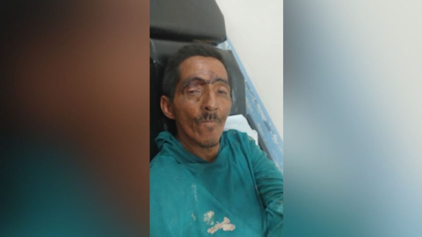 Hospital João Lúcio busca familiares de paciente que recebeu alta médica