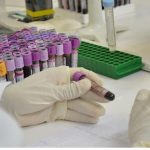 Amostras de sangue em laboratório, com profissional usando luvas e anotando dados.