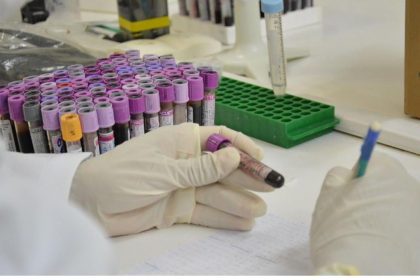 Amostras de sangue em laboratório, com profissional usando luvas e anotando dados.