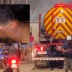 Ferimentos na pele de uma pessoa e um caminhão de bombeiros ao fundo