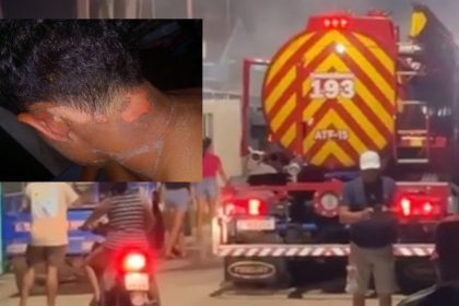 Ferimentos na pele de uma pessoa e um caminhão de bombeiros ao fundo