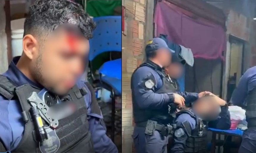 Guarda Municipal ferido durante ação no Centro de Manaus.