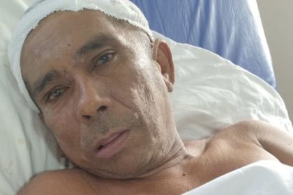 Homem em leito hospitalar com curativo na cabeça, possivelmente em busca de familiares.