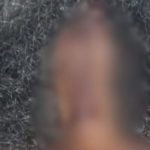 Imagem desfocada de rosto e cabelo, possivelmente de mulher com marcas de agressão.