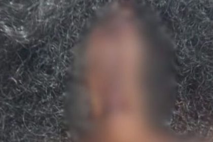 Imagem desfocada de rosto e cabelo, possivelmente de mulher com marcas de agressão.