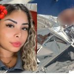 Letícia Gomes, vítima de incêndio, com flor no cabelo e em ambiente hospitalar.