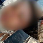 Mulher com queimaduras em corpo, Letícia Gomes do Nascimento, e rosto em imagem menor.