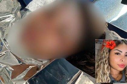 Mulher com queimaduras em corpo, Letícia Gomes do Nascimento, e rosto em imagem menor.