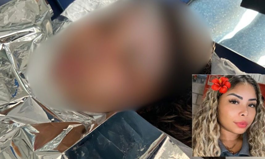 Mulher com queimaduras em corpo, Letícia Gomes do Nascimento, e rosto em imagem menor.