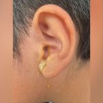 Servidor do TJAM é investigado por perfurar tímpano de criança em Manaus