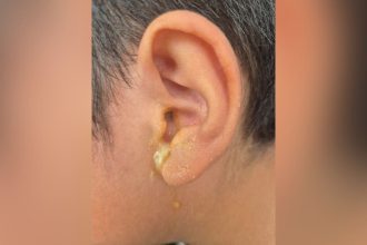 Servidor do TJAM é investigado por perfurar tímpano de criança em Manaus