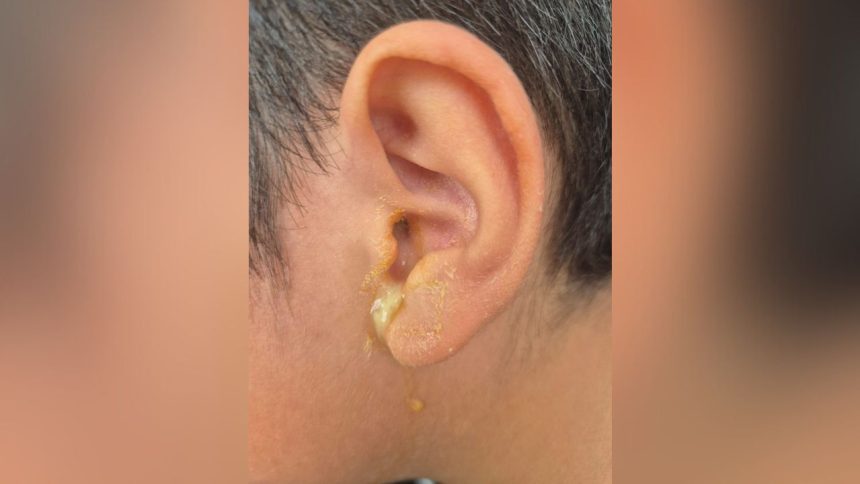 Servidor do TJAM é investigado por perfurar tímpano de criança em Manaus