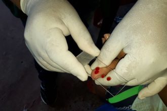 Coleta de sangue para teste de malária em Manaus.
