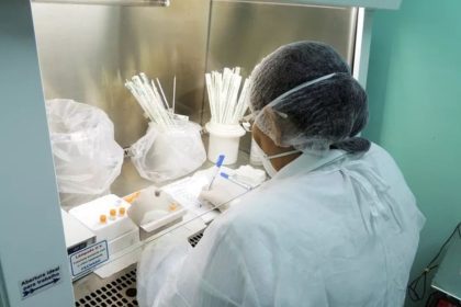 Amazonas registra primeira morte humana por esporotricose