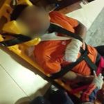 Homem ferido em maca com curativo no braço, possivelmente vítima de agressão.