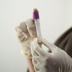 Profissional de saúde segurando tubo de ensaio em luvas, provavelmente para coleta de amostra.