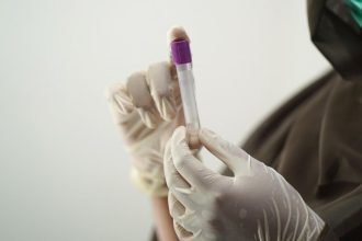 Profissional de saúde segurando tubo de ensaio em luvas, provavelmente para coleta de amostra.