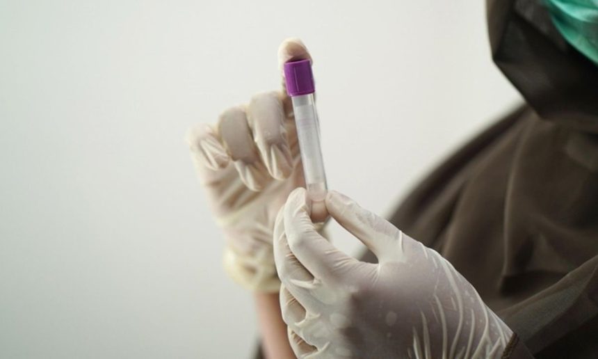 Profissional de saúde segurando tubo de ensaio em luvas, provavelmente para coleta de amostra.