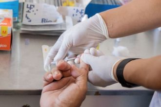 Teste de sangue para sífilis em jovem adulto. Profissional com luvas coleta amostra.