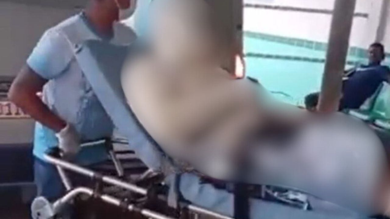 Explosão em usina de asfalto deixa trabalhador ferido no interior do Amazonas