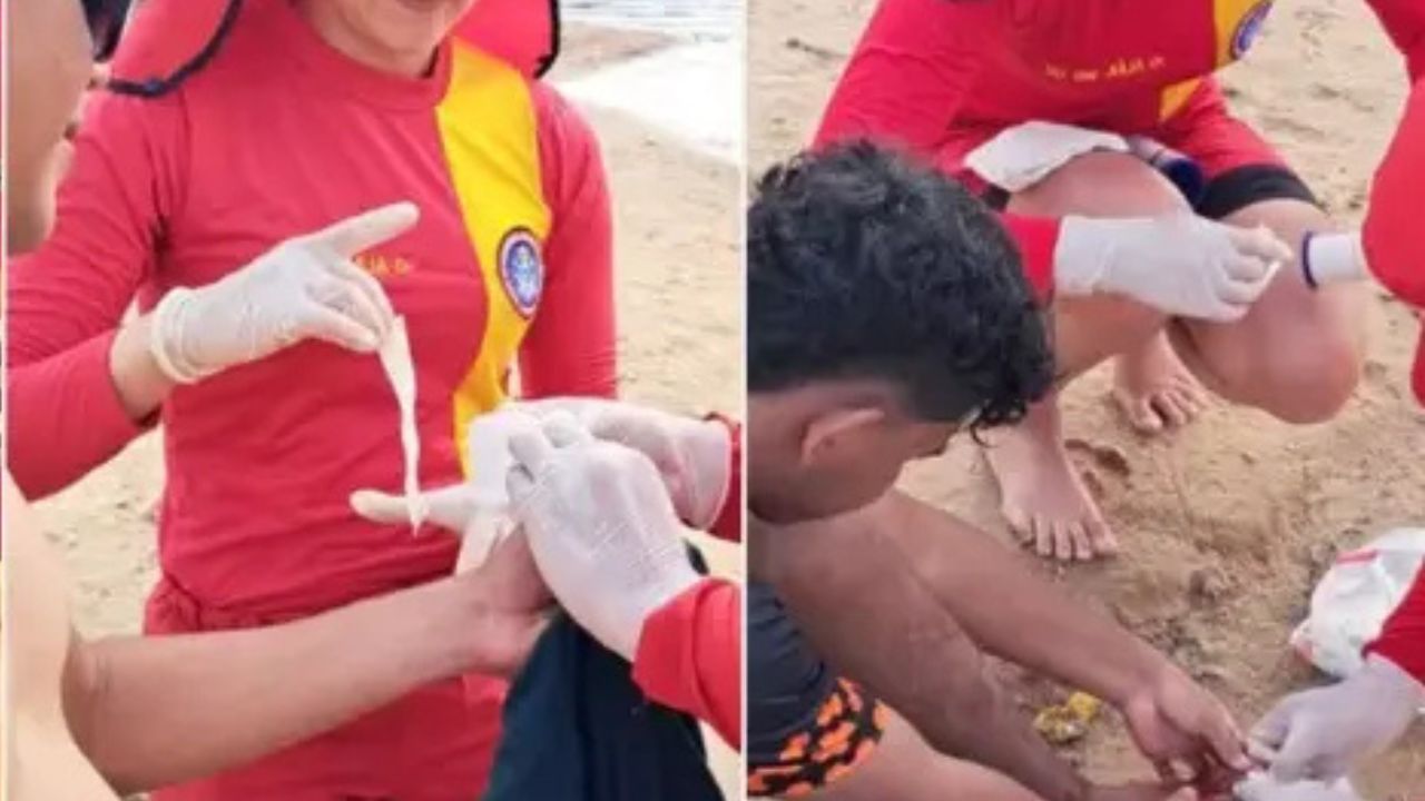 Seis pessoas são atacadas por piranhas em balneário de Manacapuru