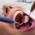 Dentista examinando a boca de um paciente com instrumentos odontológicos, usando um espelho.