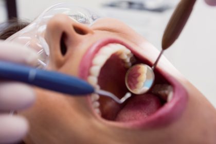 Dentista examinando a boca de um paciente com instrumentos odontológicos, usando um espelho.