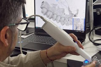 Dentista usando scanner intraoral para digitalizar um molde dentário e analisar em um computador.