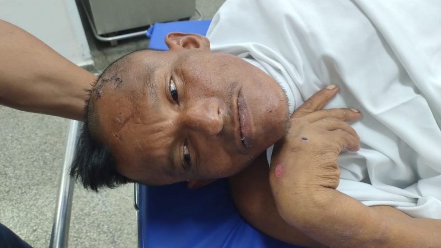 Paciente em leito hospitalar com ferimentos e suturas na cabeça.